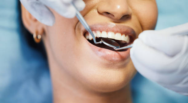 Best Emergency Root Canal Therapy in Port Royal, SC